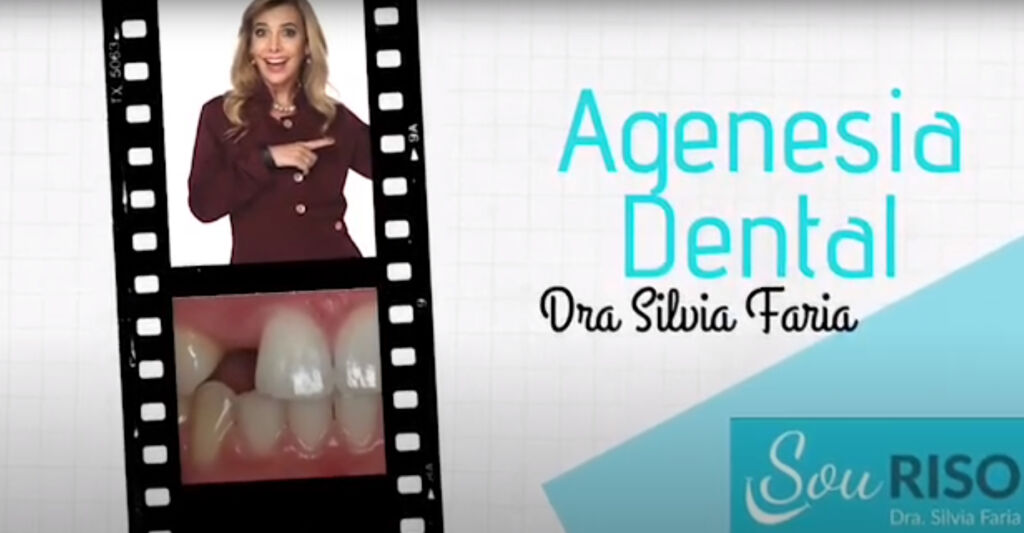 Agenesia dental. Quais as consequências a nível de saúde