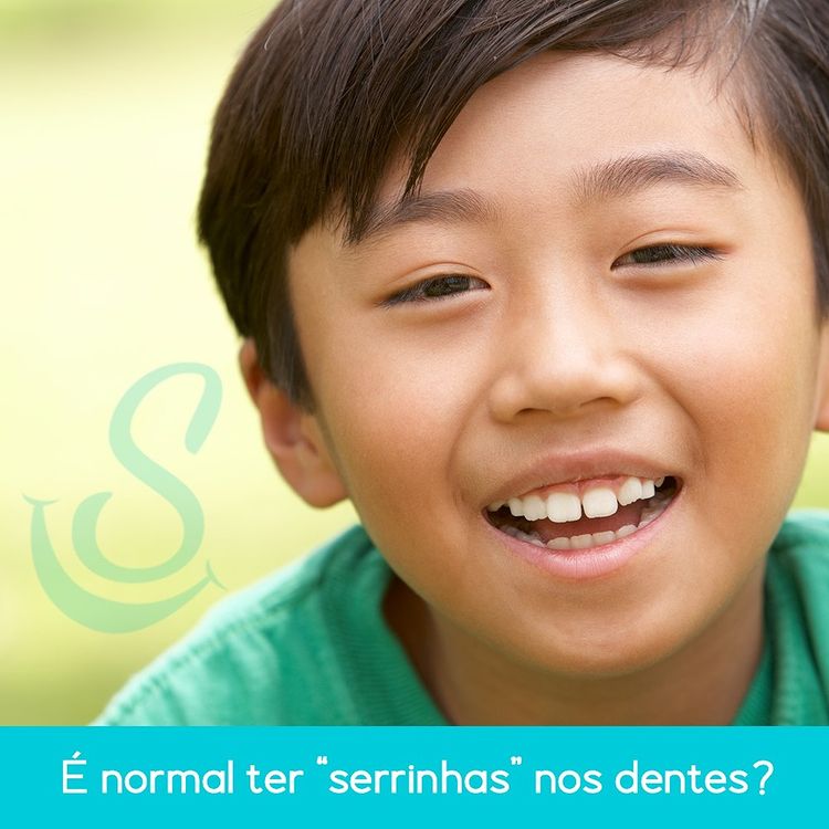 É normal ter serrinhas nos dentes