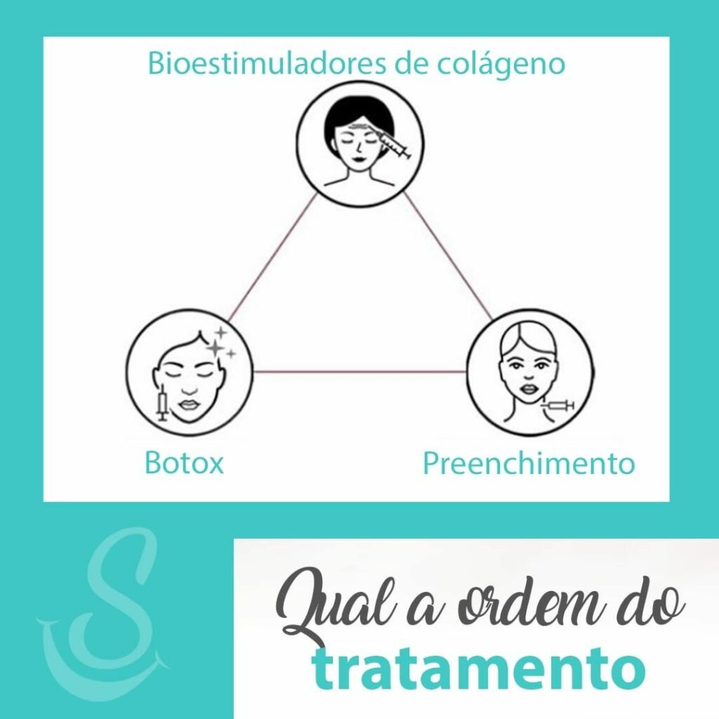 Bioestimuladores de colágeno, Botox, Preenchimento, Qual a ordem do tratamento?