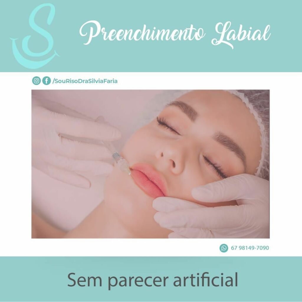 Preenchimento Labial sem parecer artificial