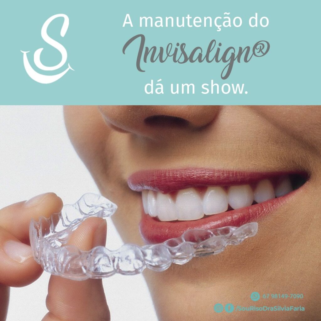 A manutenção do Invisalign dá um Show