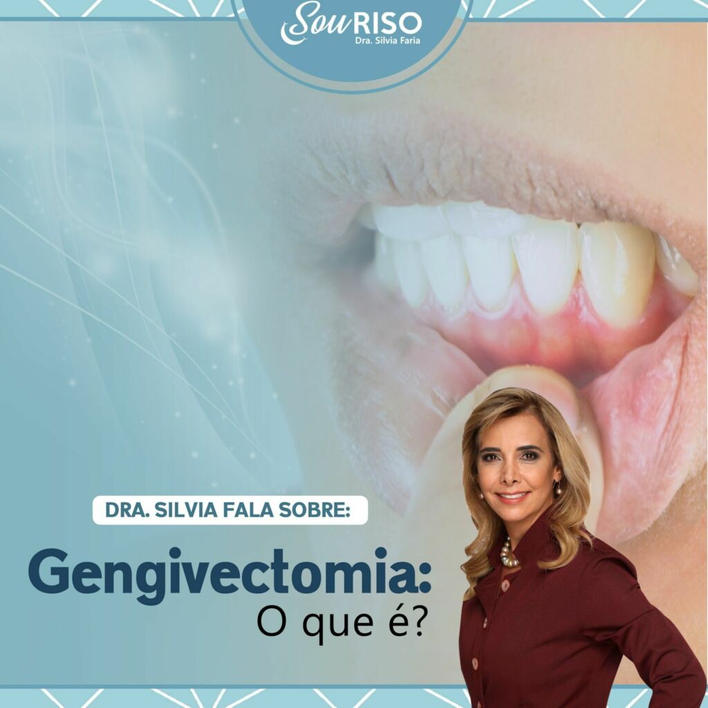 Gengivectomia, O que é?