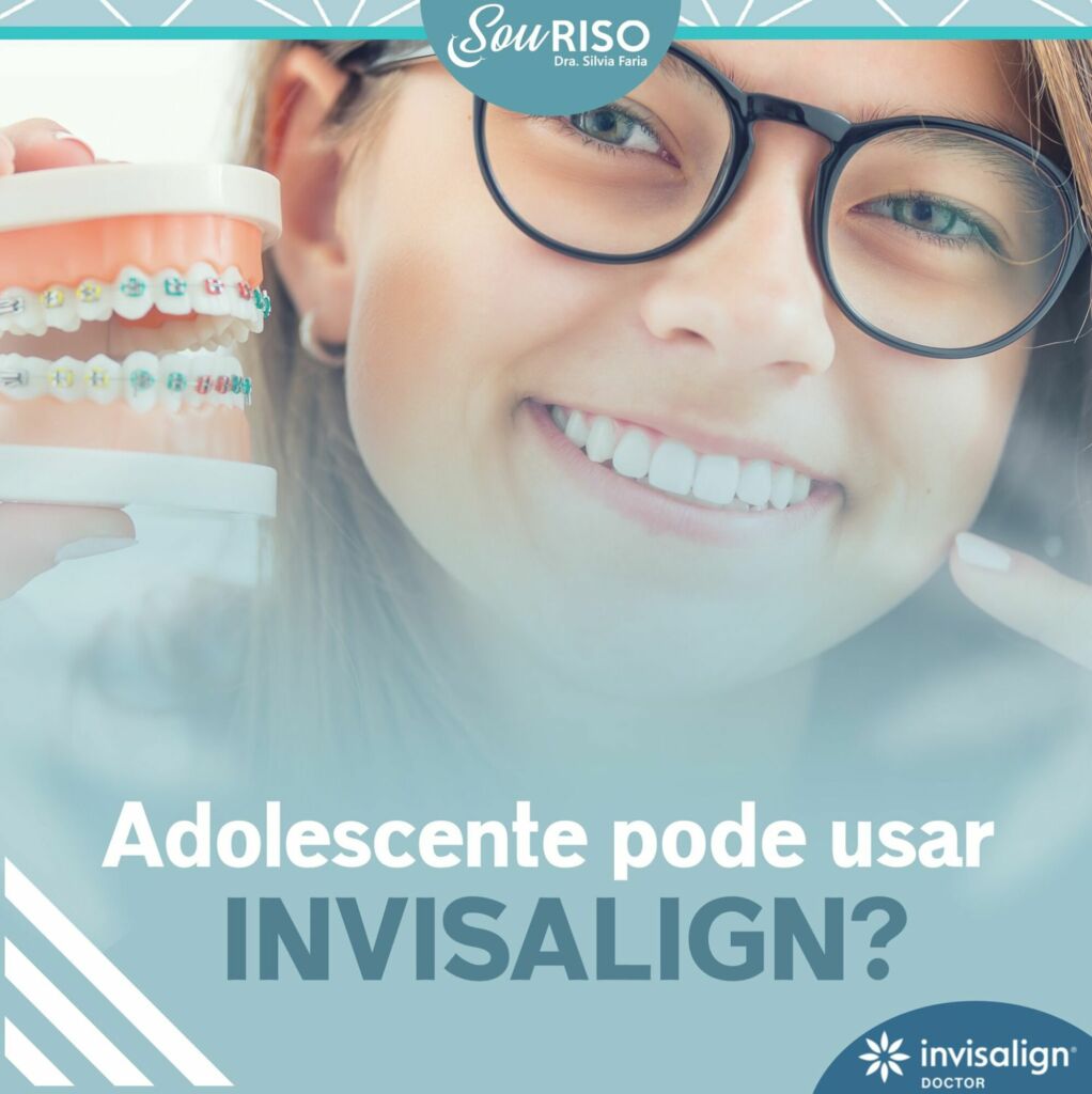 Adolescente pode usar Invisalign?