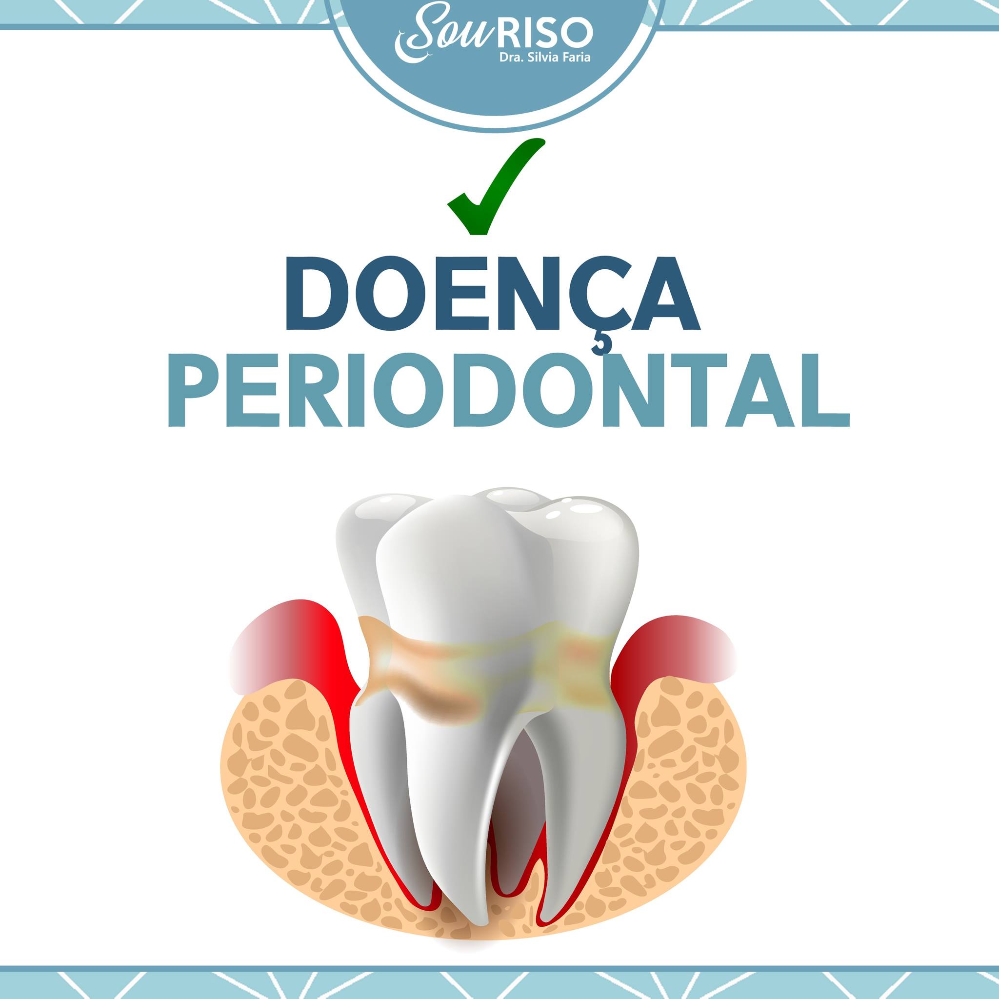Doença Periodontal - SouRiso - Dra. Silvia Faria - Paranaíba - MS ...