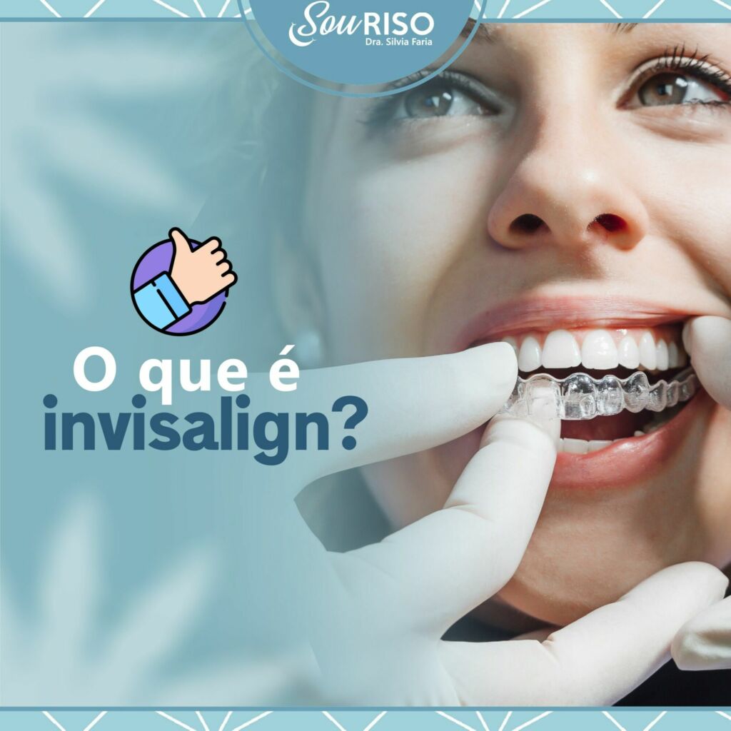 O que é invisalign