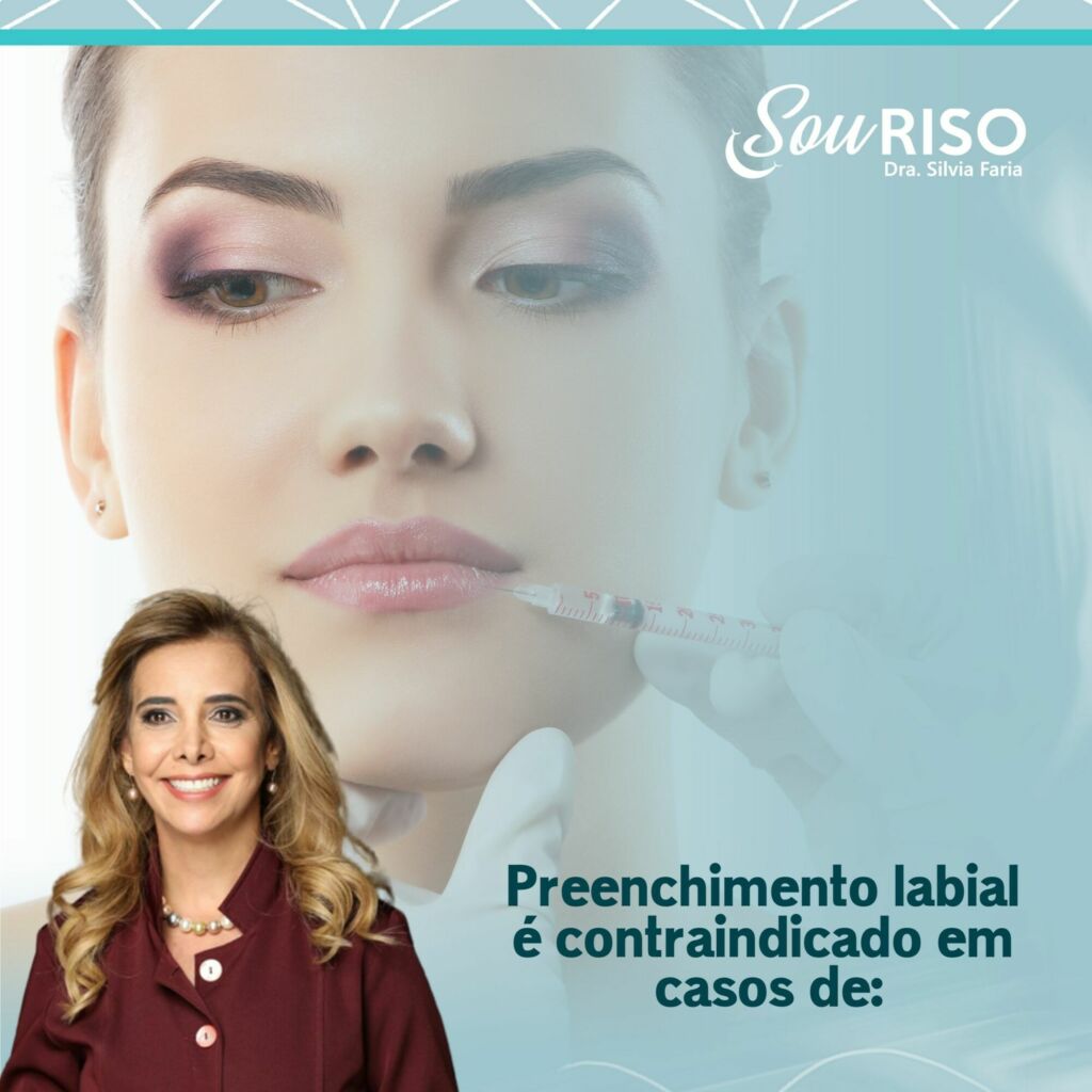 Preenchimento labial é contraindicado em casos de: