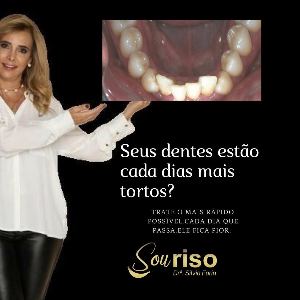 Seus dentes estão cada dia mais tortos?