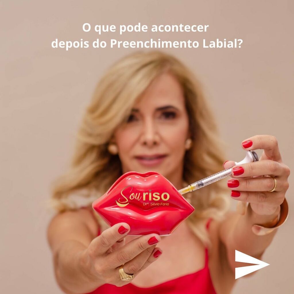 O que é Preenchimento Labial