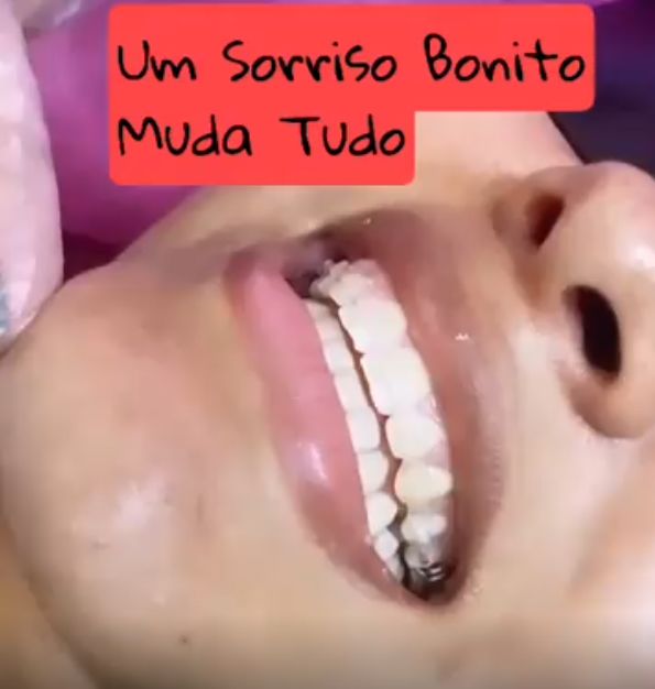 Um Sorriso Bonito muda tudo