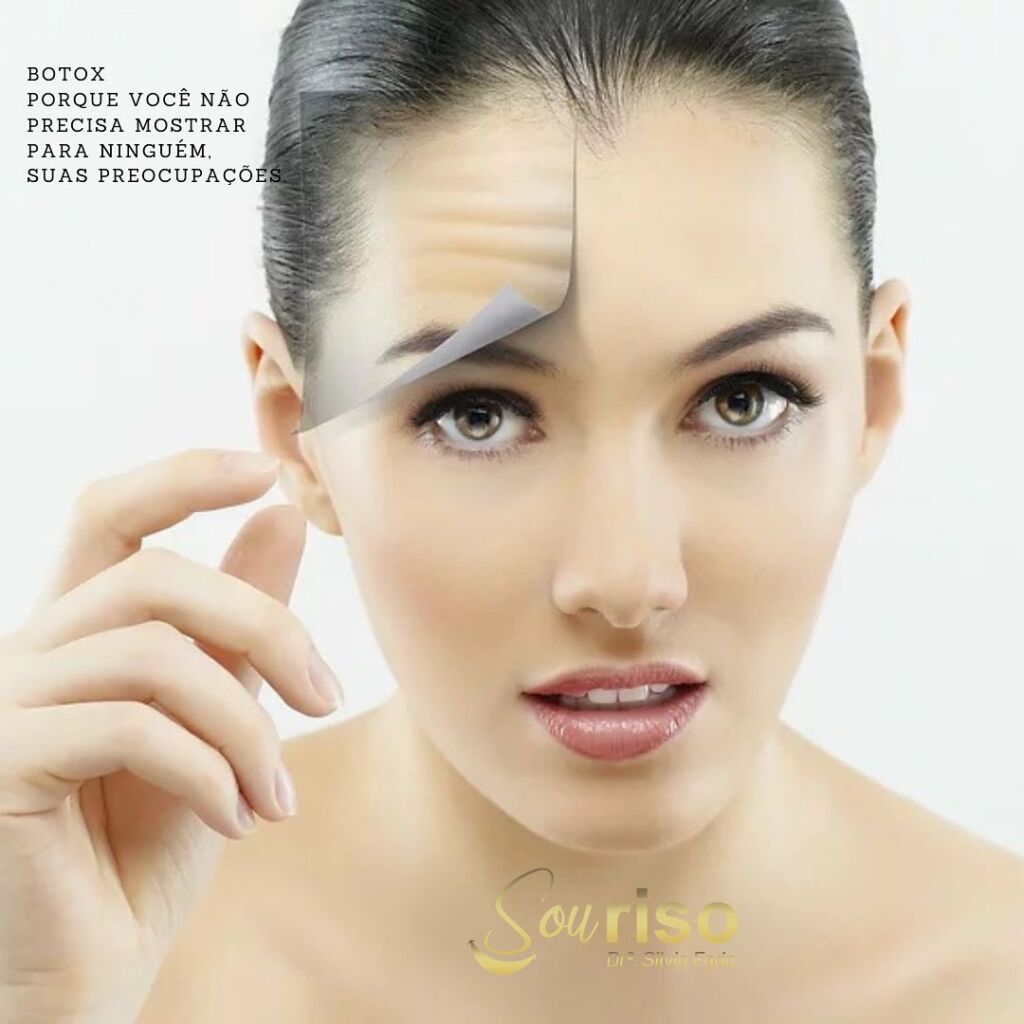 Botox porque você não precisa mostrar para ninguém, suas preocupações