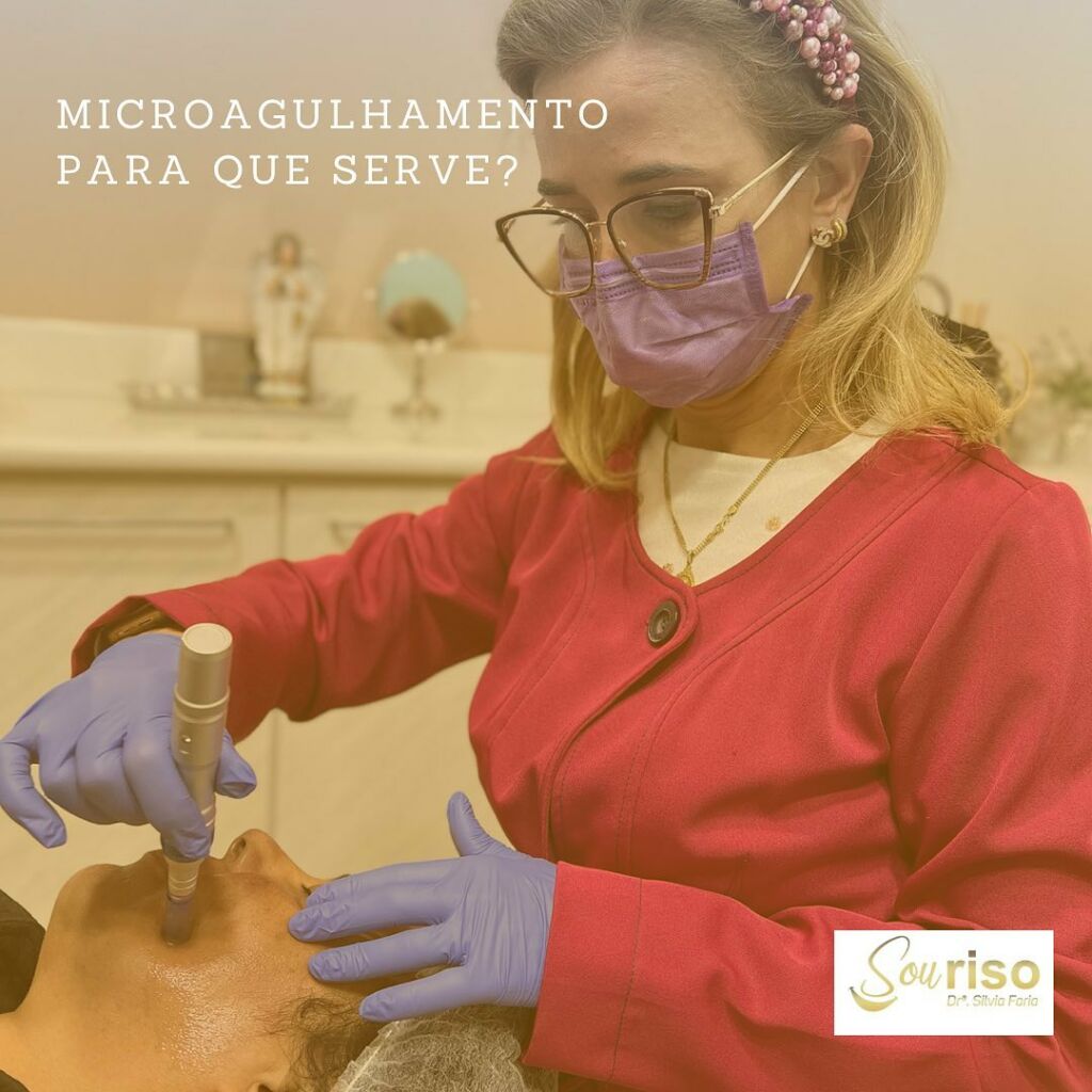 Microagulhamento para que serve