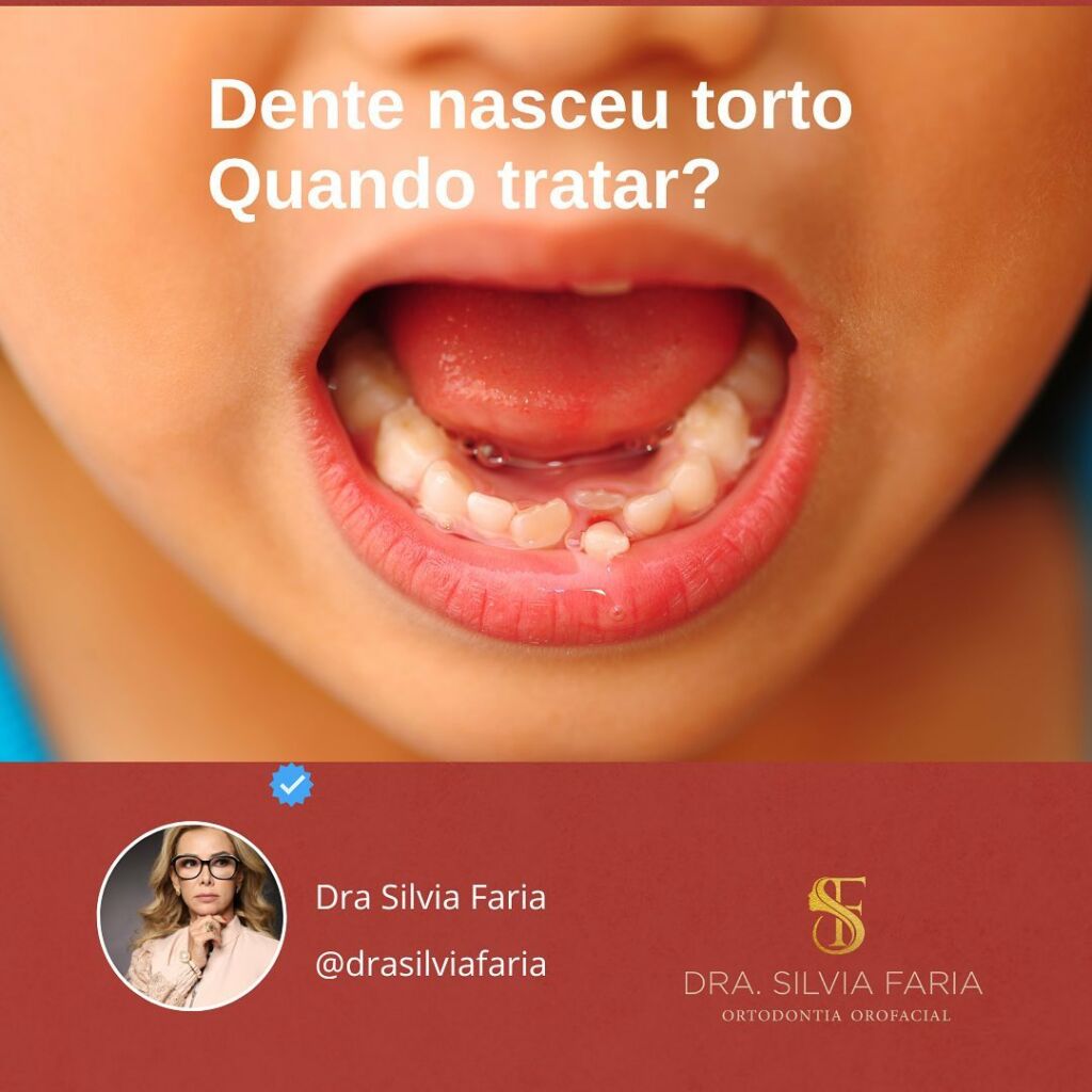 Dente nasceu torto, Quando Tratar?