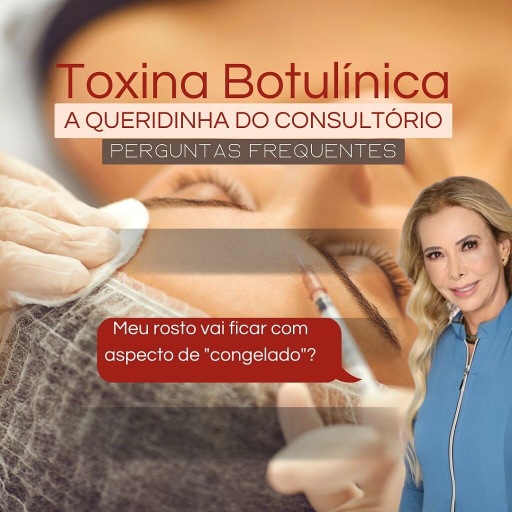 Toxina Botulínica a queridinha do consultório