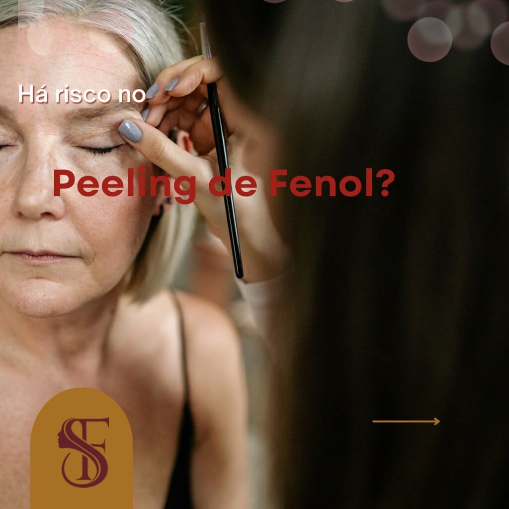 Há risco no Peeling de Fenol?