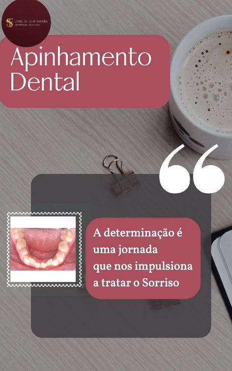 Devo tratar o apinhamento Dental