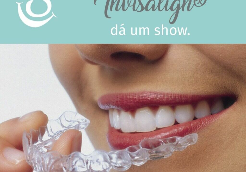 A manutenção do Invisalign dá um Show