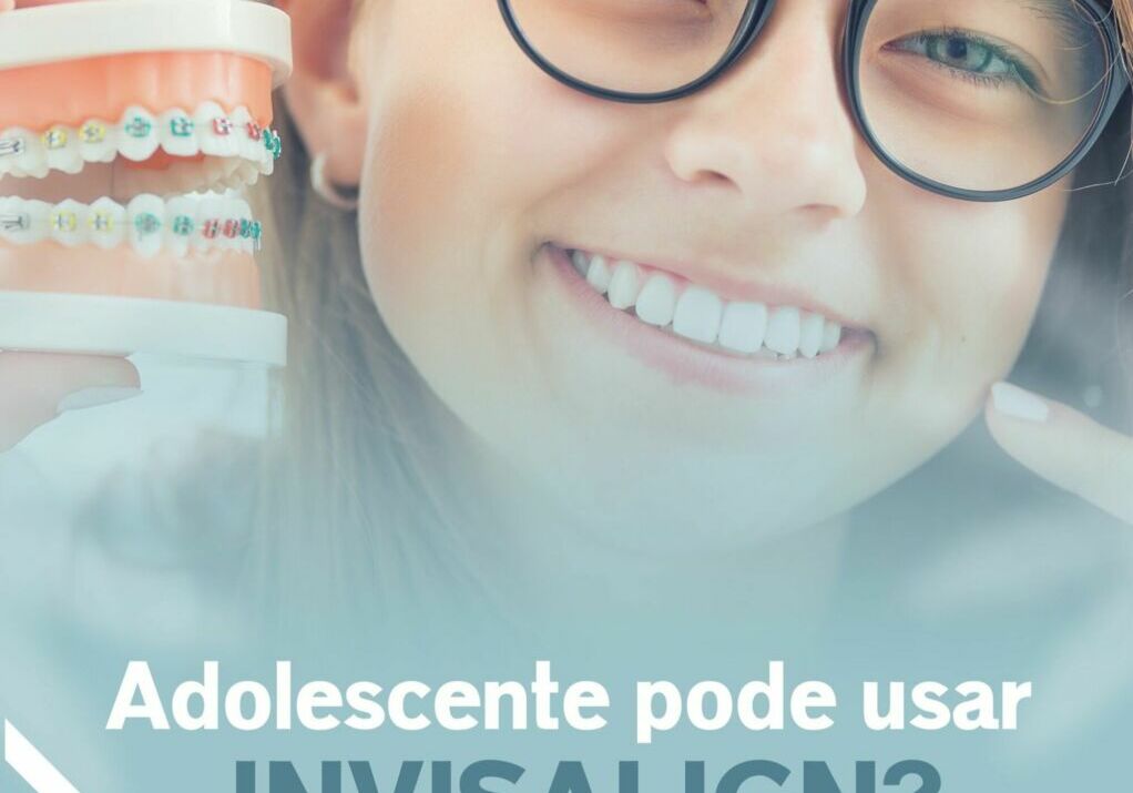 Adolescente pode usar Invisalign?