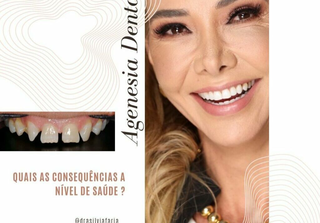 Agenesia dental, quais as consequência a nível de saúde?