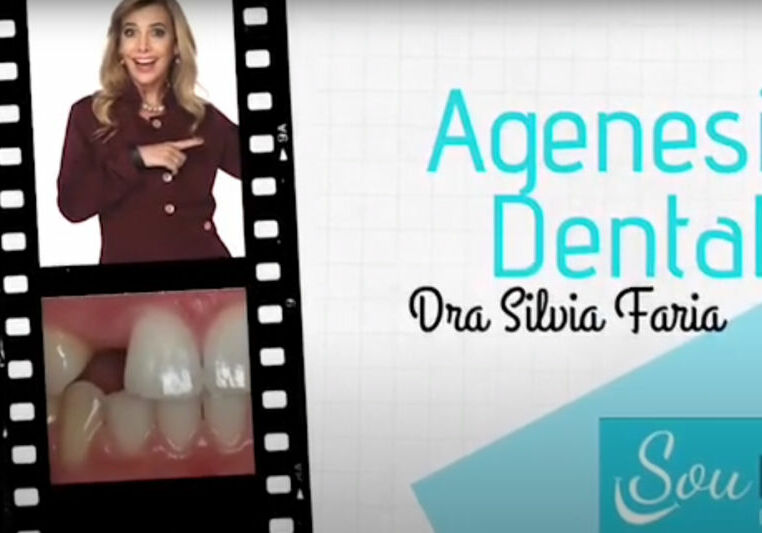 Agenesia dental. Quais as consequências a nível de saúde