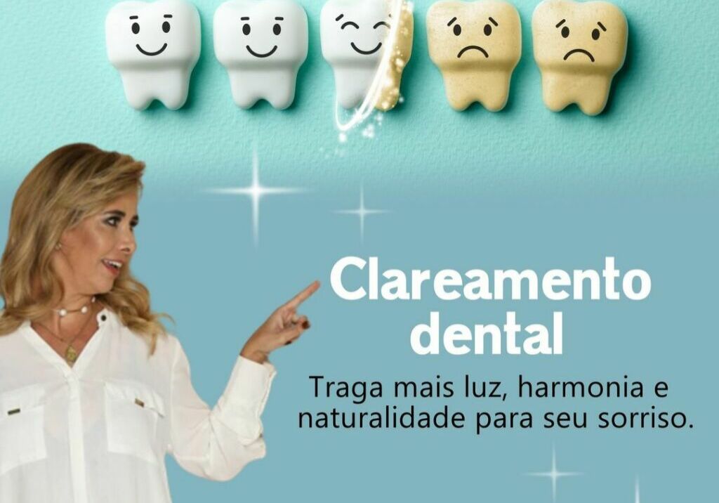 Clareamento Dental