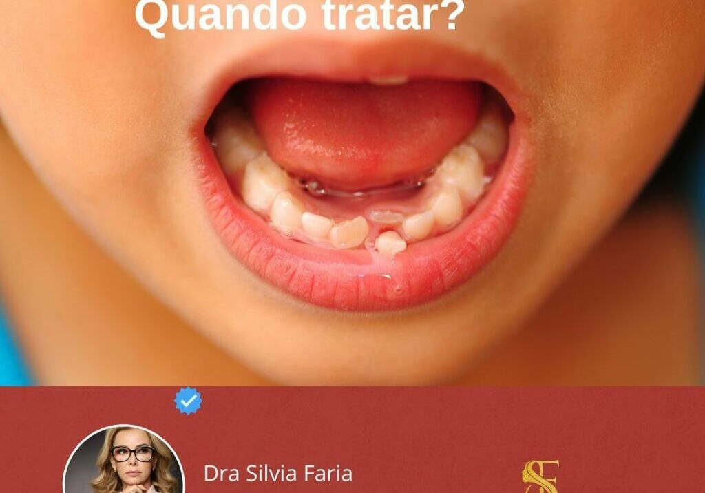 Dente nasceu torto, Quando Tratar?