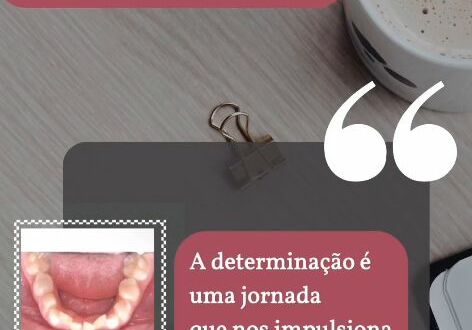 Devo tratar o apinhamento Dental