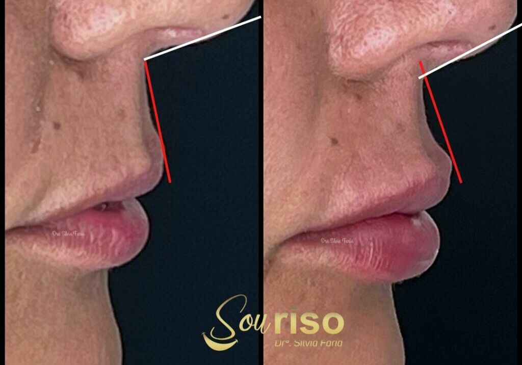 Estrutura Labial delineando sua beleza