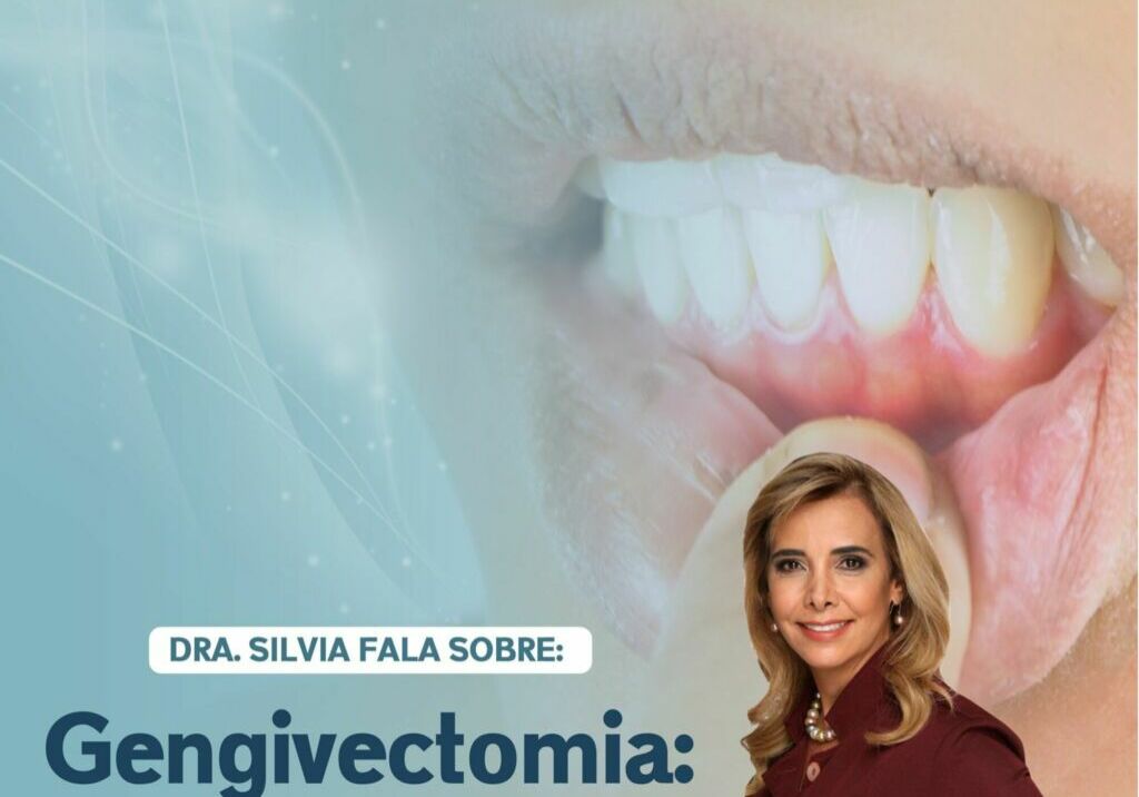 Gengivectomia, O que é?