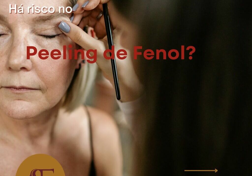 Há risco no Peeling de Fenol?