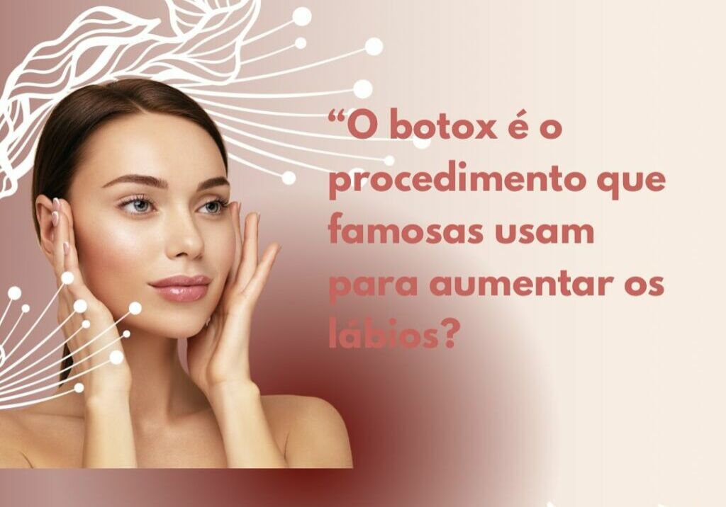 O Botox é o procedimento que famosas usam para aumentar os lábios
