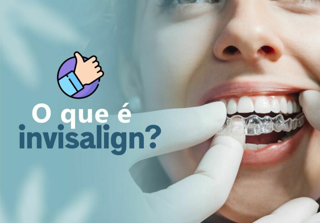 O que é invisalign