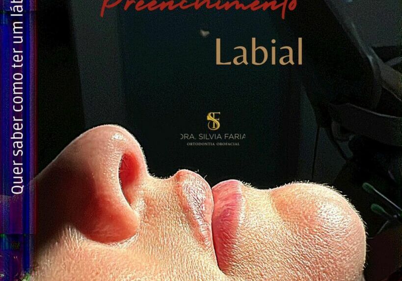 Preenchimento Labial