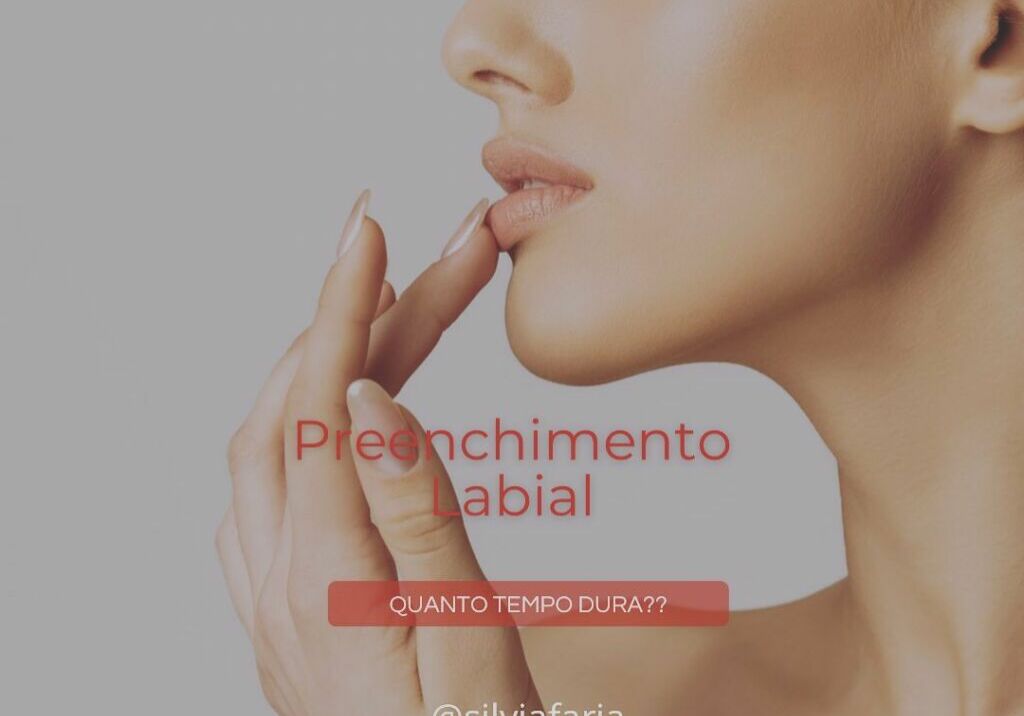 Preenchimento Labial, quanto tempo dura