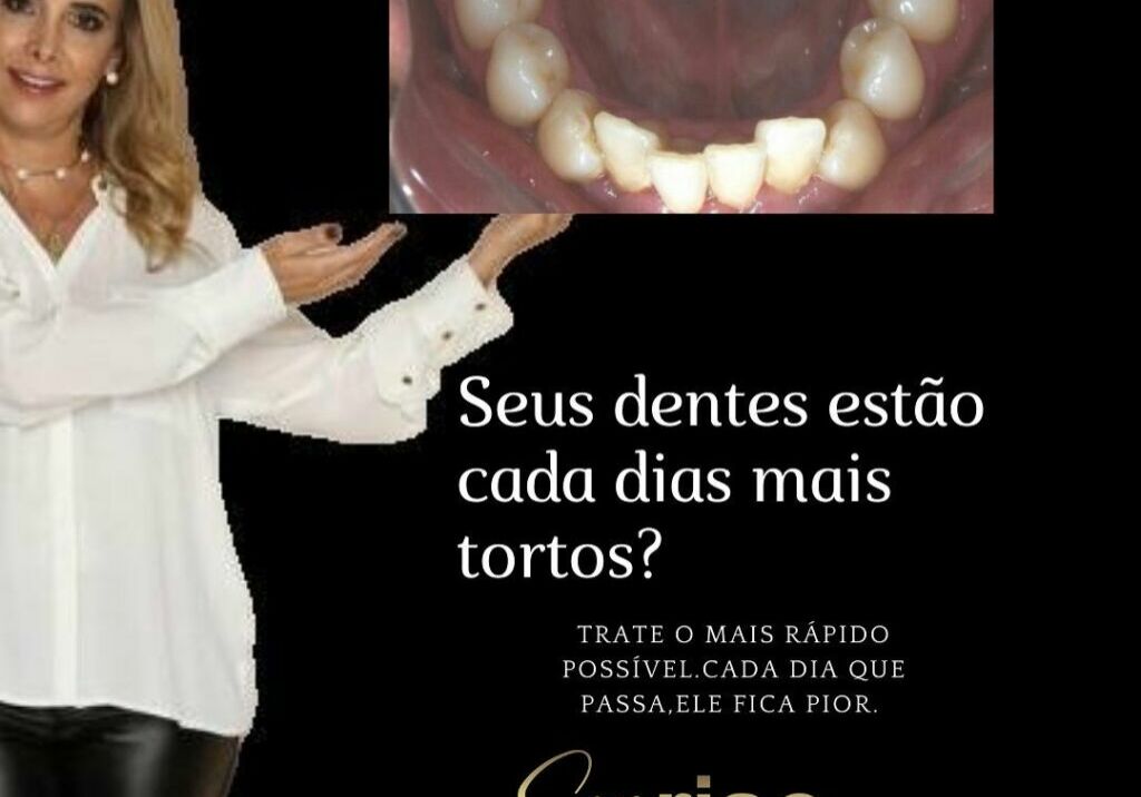 Seus dentes estão cada dia mais tortos?