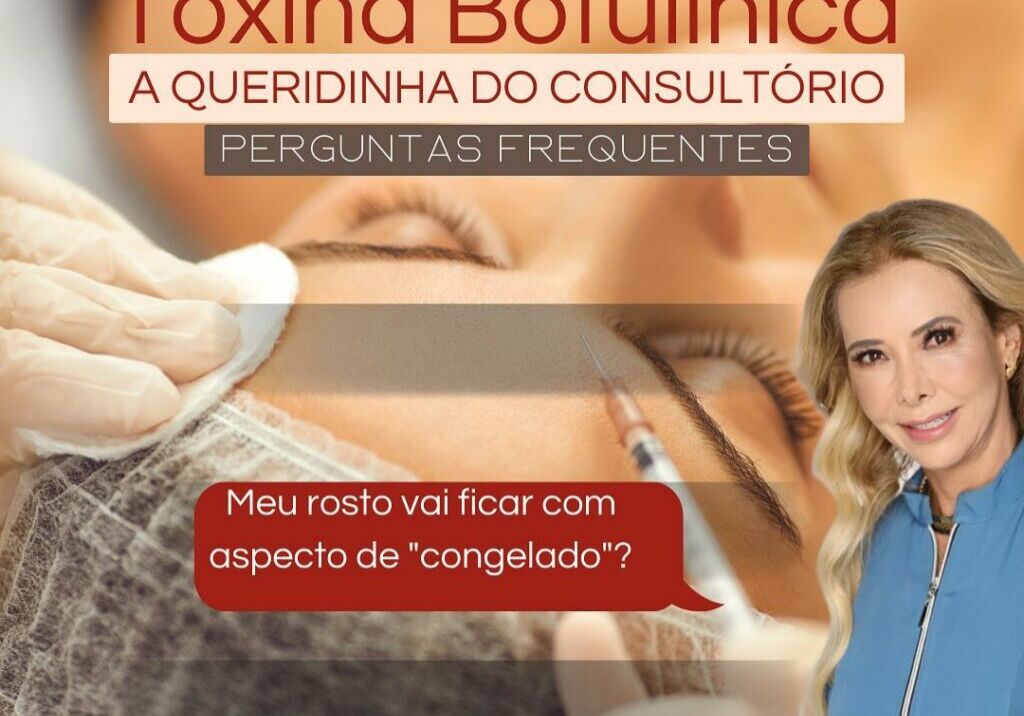 Toxina Botulínica a queridinha do consultório