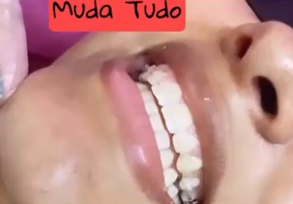 Um Sorriso Bonito muda tudo